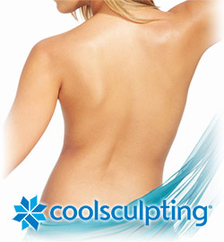 Coolsculpting model and logo